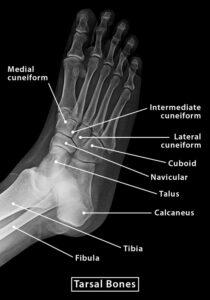 Tarsal Bones – Definition, Anatomy, Location, & Functions