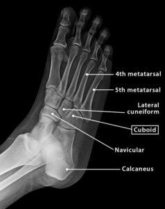 Cuboid Bone - Definition, Location, Anatomy, & Diagram