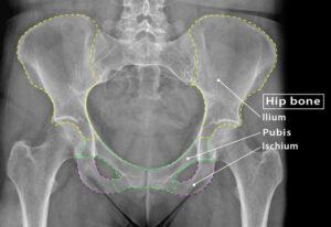 Hip Bone (Coxal Bone) – Anatomy, Location, Functions, & Diagram