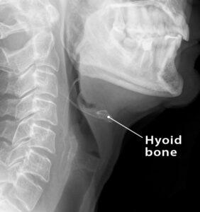 Hyoid Bone – Location, Functions, Anatomy, & Labeled Diagram