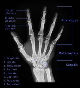 Hand Bones - Names & Structure with Labeled Diagrams